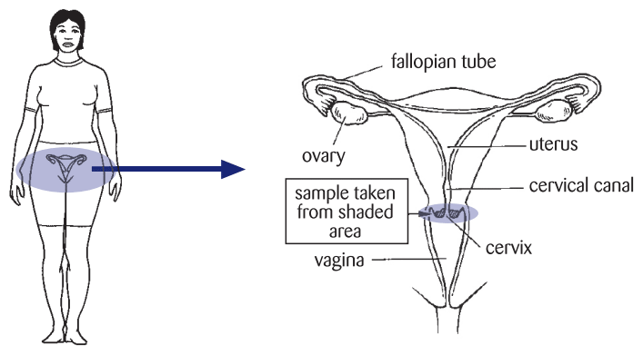 Diagram showing the location of the cervix, where the sample is taken from. 
